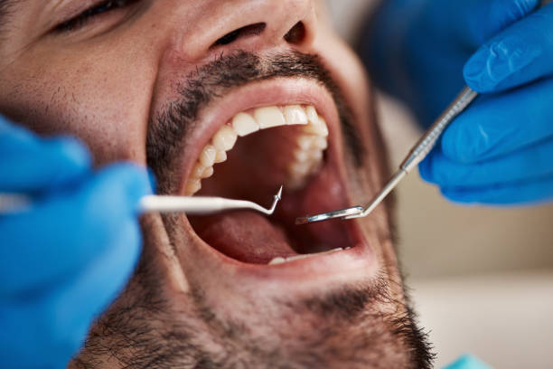 Urgent Tooth Repair in RI