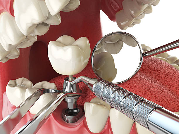 Best Emergency Gum Pain Relief  in Harmony, RI